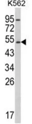 Anti-CYP2E1 antibody, C-term used in Western Blot (WB). GTX81120