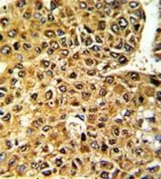 Anti-MLX antibody, Internal used in IHC (Paraffin sections) (IHC-P). GTX81125
