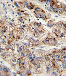 Anti-EHHADH antibody, C-term used in IHC (Paraffin sections) (IHC-P). GTX81126