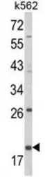 Anti-CD94 antibody, N-term used in Western Blot (WB). GTX81129