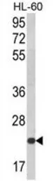 Anti-NKG2C antibody, N-term used in Western Blot (WB). GTX81130