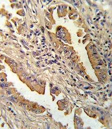 Anti-CXCL8 / IL8 antibody, C-term used in IHC (Paraffin sections) (IHC-P). GTX81140