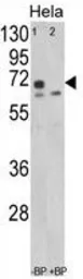 Anti-LMOD1 antibody, Internal used in Western Blot (WB). GTX81141