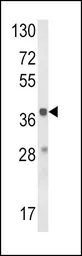 Anti-HAO1 antibody, Internal used in Western Blot (WB). GTX81144