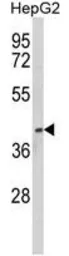 Anti-PON3 antibody, N-term used in Western Blot (WB). GTX81152