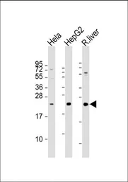 Anti-TSPAN31 antibody, Internal used in Western Blot (WB). GTX81157