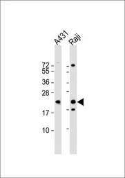 Anti-LMP2 antibody, C-term used in Western Blot (WB). GTX81175