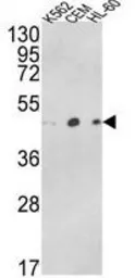 Anti-ACTR3B antibody, C-term used in Western Blot (WB). GTX81186