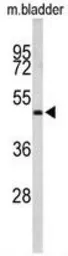 Anti-ACTR3B antibody, C-term used in Western Blot (WB). GTX81186