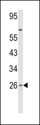 Anti-Interferon beta antibody, N-term used in Western Blot (WB). GTX81187