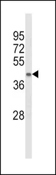Anti-ACADL antibody, Internal used in Western Blot (WB). GTX81189