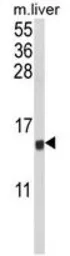 Anti-MIP1 alpha antibody, C-term used in Western Blot (WB). GTX81195