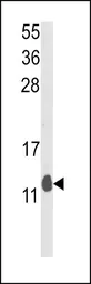 Anti-PEA15 antibody, C-term used in Western Blot (WB). GTX81197