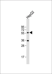 Anti-CYP7A1 antibody, C-term used in Western Blot (WB). GTX81230