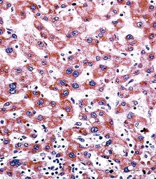 Anti-Cytochrome P450 2C9 antibody, N-term used in IHC (Paraffin sections) (IHC-P). GTX81255