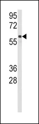 Anti-Cytochrome P450 2C9 antibody, N-term used in Western Blot (WB). GTX81255