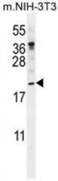 Anti-Pleiotrophin antibody, N-term used in Western Blot (WB). GTX81295