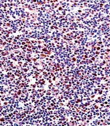 Anti-RUNX2 antibody used in IHC (Paraffin sections) (IHC-P). GTX81326