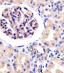 Anti-ROR1 antibody used in IHC (Paraffin sections) (IHC-P). GTX81334