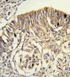Anti-PLTP antibody, C-term used in IHC (Paraffin sections) (IHC-P). GTX81352