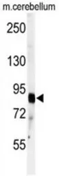 Anti-ADAMTS4 antibody, C-term used in Western Blot (WB). GTX81446