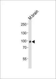 Anti-ADAMTS4 antibody, C-term used in Western Blot (WB). GTX81446