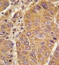 Anti-Apolipoprotein A1 antibody, N-term used in IHC (Paraffin sections) (IHC-P). GTX81467