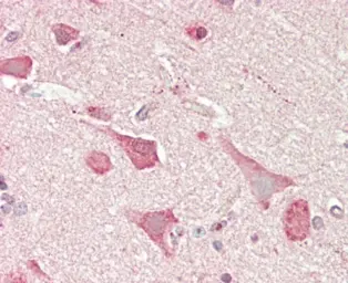 Anti-n-Myc antibody, C-term used in IHC (Paraffin sections) (IHC-P). GTX81475
