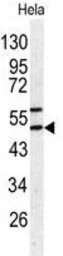 Anti-HSP47 antibody, C-term used in Western Blot (WB). GTX81503