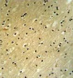 Anti-BCOR antibody, Internal used in IHC (Paraffin sections) (IHC-P). GTX81506