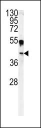 Anti-Carbonic Anhydrase 14 antibody, N-term used in Western Blot (WB). GTX81537