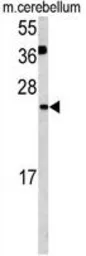 Anti-Glutaredoxin 2 antibody, C-term used in Western Blot (WB). GTX81538
