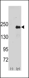 Anti-JLP antibody, Internal used in Western Blot (WB). GTX81547