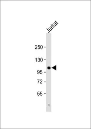 Anti-PARG antibody, C-term used in Western Blot (WB). GTX81550