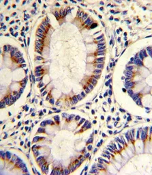 Anti-ARGBP2 antibody, N-term used in IHC (Paraffin sections) (IHC-P). GTX81600