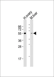 Anti-LAG3 antibody, Internal used in Western Blot (WB). GTX81605