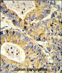 Anti-RPS18 antibody, Internal used in IHC (Paraffin sections) (IHC-P). GTX81669