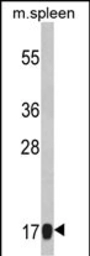 Anti-RPS18 antibody, Internal used in Western Blot (WB). GTX81669