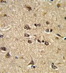 Anti-RAIN antibody, Internal used in IHC (Paraffin sections) (IHC-P). GTX81679