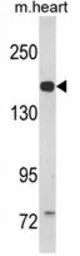 Anti-CORIN antibody, Internal used in Western Blot (WB). GTX81681
