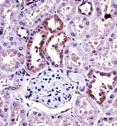 Anti-M-CSF antibody, Internal used in IHC (Paraffin sections) (IHC-P). GTX81735