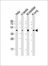 Anti-Wnt4 antibody, Internal used in Western Blot (WB). GTX81775