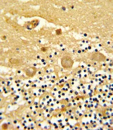 Anti-GARP antibody, Internal used in IHC (Paraffin sections) (IHC-P). GTX81794