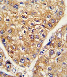 Anti-GARP antibody, Internal used in IHC (Paraffin sections) (IHC-P). GTX81794