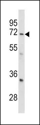 Anti-GARP antibody, Internal used in Western Blot (WB). GTX81794
