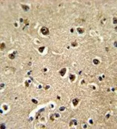 Anti-BAALC antibody, N-term used in IHC (Paraffin sections) (IHC-P). GTX81815