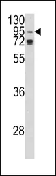 Anti-AGO1 antibody, N-term used in Western Blot (WB). GTX81841