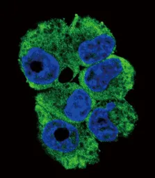 Anti-CD40L / CD154 antibody, N-term used in Immunocytochemistry/ Immunofluorescence (ICC/IF). GTX81854