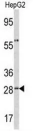 Anti-alpha 1 Acid Glycoprotein antibody, C-term used in Western Blot (WB). GTX81862