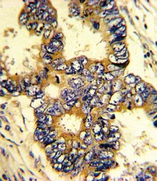 Anti-EPN3 antibody, N-term used in IHC (Paraffin sections) (IHC-P). GTX81869